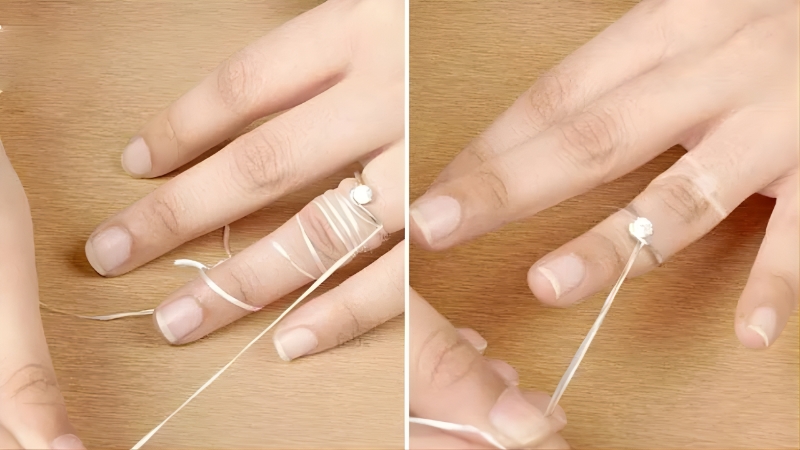 Phương pháp tháo nhẫn bị chật bằng chỉ nha khoa