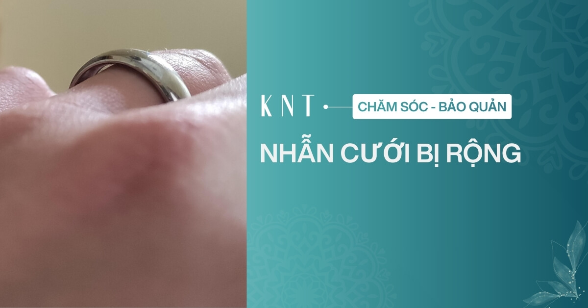 Nhẫn cưới bị rộng phải làm sao? Cách khắc phục hiệu quả