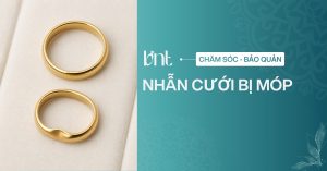 Nhẫn cưới bị móp có sao không? Cách xử lý an toàn tại nhà