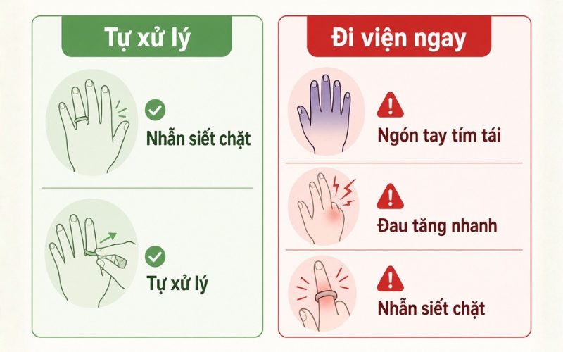 Dấu hiệu nhẫn bị kẹt vào tay cần đi bệnh viện ngay