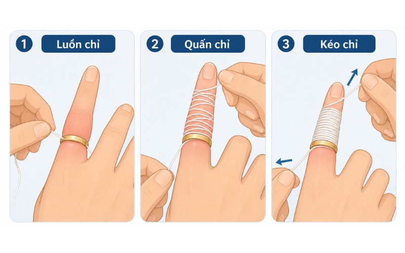 Cách tháo nhẫn chật bằng chỉ nha khoa