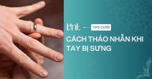 Cách tháo nhẫn khi tay bị sưng an toàn: Hướng dẫn chi tiết