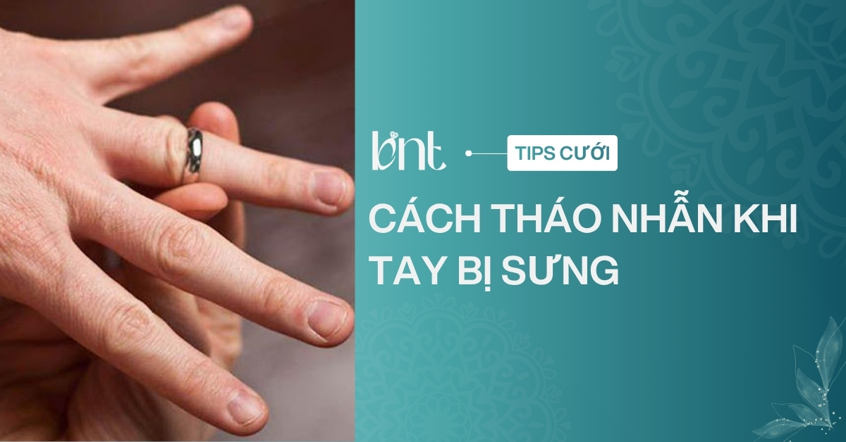 Cách tháo nhẫn khi tay bị sưng an toàn: Hướng dẫn chi tiết